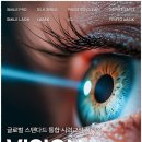 (기초) 컴퓨터와 스마트폰 | 스마트라식 후기 핵심 요약: 수술 결정 전 꼭 확인해야 할 5가지