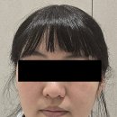 얼굴이 정돈 안 된 느낌? 아이디피부과 뉴울쿼 상담부터 후기까지