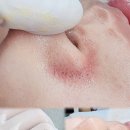 까만코 이미지
