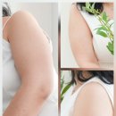 르로제의원 네이버블로그