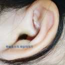 H6038 네이버블로그