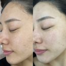 롯데캐슬아파트 후문~소나무집 | 레이저 잡티 색소 관리로 얼굴이 살아나는 마산 수뷰티