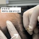 진헤어라인 네이버블로그