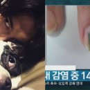 최시원 반려견에 물린 한일관 대표 체내서 '녹농균' 검출 이미지