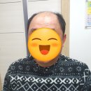센스모 이미지