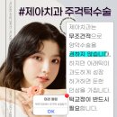 제아시스템 네이버블로그
