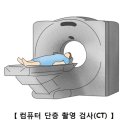 전격성 간염(Fulminant Hepatic Failure) 이미지