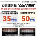 스노우기공소 이미지