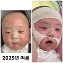 하나님께서 하셨습니다.(수호의 아토피치유) 이미지