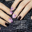 강자안손톱 이미지