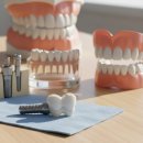 호갱탈출 | 보철치료 종류와 가격, 치과 가기 전 이것만은 꼭 알고 가세요 (호갱 탈출 후기)