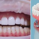 이치과기공소 이미지