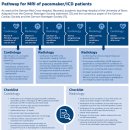 뢴트겐라인 이미지