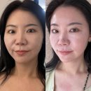 건대피부관리 더나은피부바디 - 바른 자세를 되찾아주는 건대소통테라피 마사지