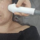 뷰티샵유에스에이 | 불당동 피부관리 뷰티에이 인퓨즈웨이브 찐후기~