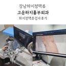 수흉부외과의원 | 고운하지흉부외과 하지정맥류검사 결과 상담 후기