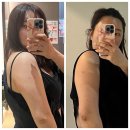 구로-구로-구로-846 | [한 달 후기] 구로 팔 지방파괴주사 추천! 인증된 주사라 믿고 맞았어요