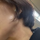 디앤에이피부과의원 | 이중턱 부자, 인생 처음 압구정에서 인어젯 (인모드 + 에어젯) 받은 솔직 후기