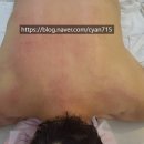 알포유수테라피