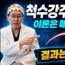 파킨슨병 줄기세포 치료, 척수강주사가 정맥주사보다 낫다? 실제 임상 결과는? 이미지