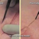 (주)이안메드테크 네이버블로그