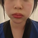 더마름 다이어트 목동점 이미지