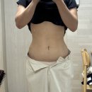 11650-17-165-11 | 내돈내산 대전 복부지흡, 팔뚝지출주 찐 후기(스압주의)