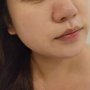 수앤수 | 부천에스테틱 부천피부관리 #수앤수뷰띠크 물광주사 후기