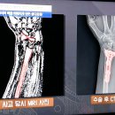 골다공증 처방, 냉장고를 털어라/Prescription osteoporosis/기치유센터 이미지