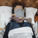 한빛나노의료기 구리지점 | 건강을 되살아나게 해주는 한빛 나노의료기 체험 <후기2>