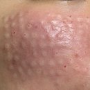 정성한의원 | 인천 서구 청라 365 정성 한의원 내돈내산 후기