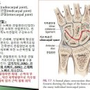 [9강, 팔과 손]뉴만운동학 7장 손목(wrist) 3(보충강의3/4), 손목관절3가지, 손목인대, TFCC 이미지