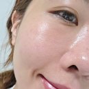 밸런스7 | 명동피부과 물광주사 엘라비에 밸런스 솔직 후기 | 피부 속건조 통증 효과 주기