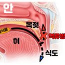 목젖 부음 원인과 목젖 부었을때 약 대처 방법 이미지