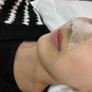 피부하우스 | 범계 피부관리 르네르하우스 블랙헤드 관리 솔직 후기