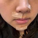 코미인의원 | 양산 물금 피부과 추천 제이드의원 점빼기후기