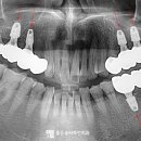 좋은솜씨죽전치과의원 이미지