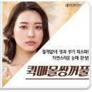 시선성형외과의원 티스토리