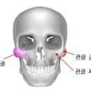 상대적 위치의 광대뼈 / 광대뼈축소 수술은? 이미지