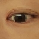 전남대학교병원동산주차장 | [전남대병원 피부과] 듀피젠트 중단 후 10주 경과_가려움·피부 변화 리얼 후기