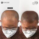 예쁜여우뷰티 이미지