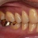 찬치과기공소 이미지