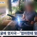 [기사] 교감 뺨 때린 초등생 얼굴 멍자국…학부모 아동학대 의심 이미지