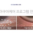 에이스아쿠아