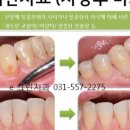 e그린치과의원 네이버블로그