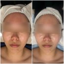 안청초등학교 | 창원 예비신부의 윤곽관리 혜리온 에스테틱 후기