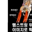 허벅지 근육, 햄스트링 통증 및 (부상, 파열) 이미지