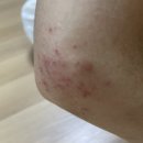 에스엘의원 이미지