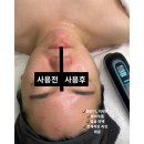 LDM 뷰티 홈디바이스 고민 중이라면｜피부 흡수·순환·탄력까지 바뀌는 기준 (슈퍼젝션디바이스)