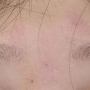 광교고운꿈피부과의원 이미지